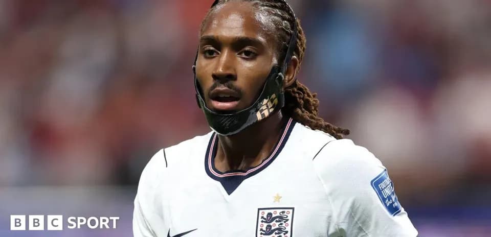 Player wearing mask during match for England
